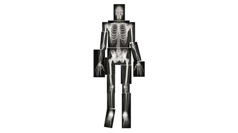 Betzold Body set 52301 i ZD